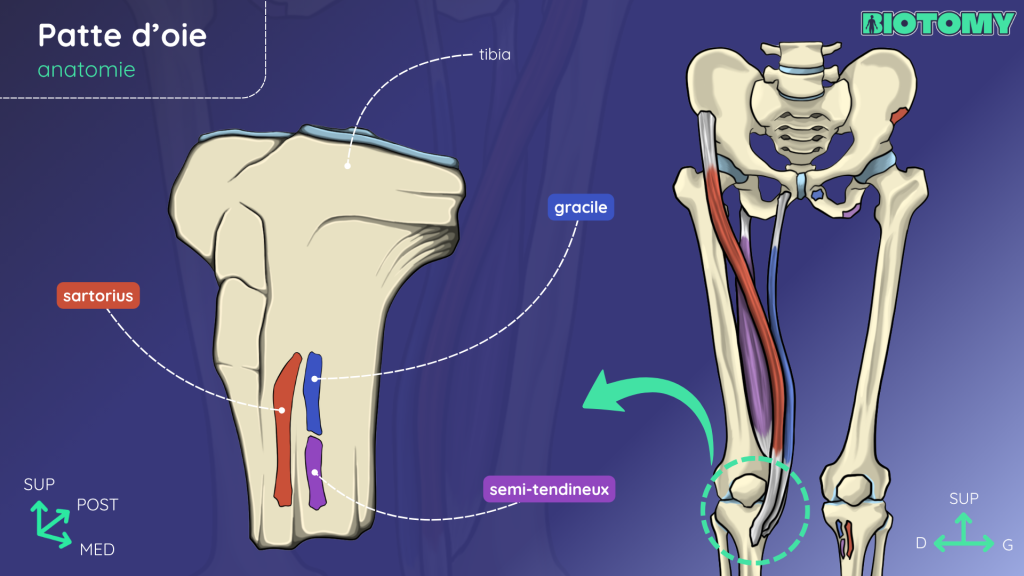 Schéma des insertions tibiales du sartorius, du gracile et du semi-tendineux formant la patte d’oie, avec une vue de leur trajet depuis le bassin.